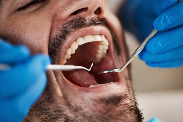 Best Mobile Emergency Dentist in Cut Off, LA